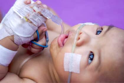 A Baby on a ventilator RSV