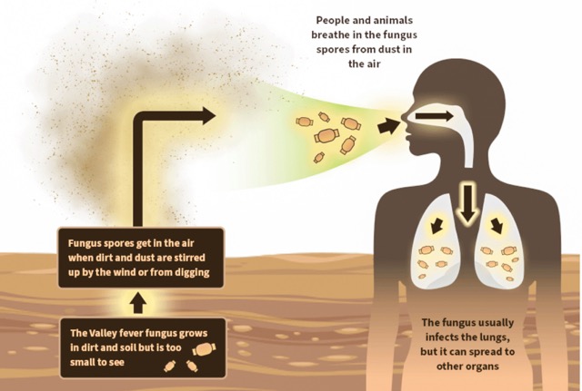 Valley Fever
