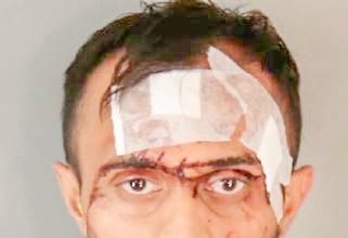 Corona Planet Fitness Hatchet Attack