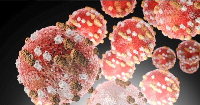 Measles